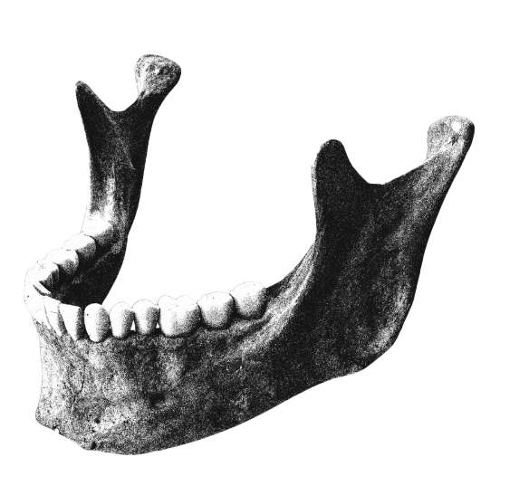 顎の模型
